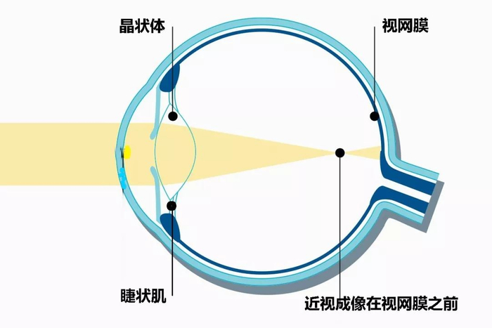 视觉后像图解