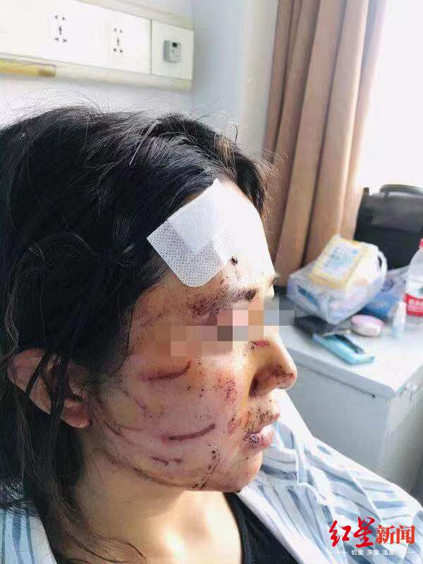 ↑孙某脸上有多处伤痕