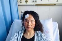 温州女子被公公丈夫暴打毁容涂大便 警方立案侦查