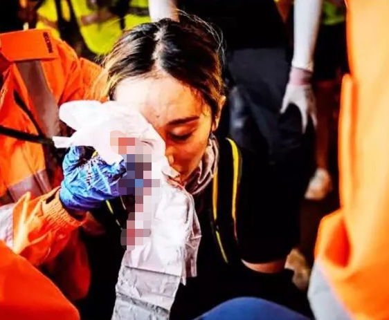 “爆眼女”（港媒）