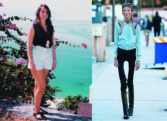 2012年，厌食症患者瓦莱里娅·莱维汀站出来接受采访，提醒人们关注厌食症问题。她16岁时127斤，39岁时只有54斤（右图）。“我收到不少女孩子的信，想让我教她们怎样才能像我一样。”（资料图片）