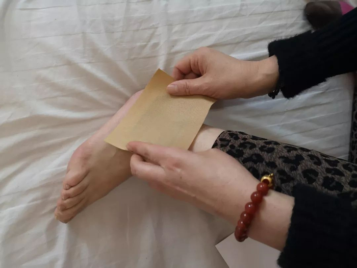 2019年1月21日，布病患者正在病房里给自己贴药膏，她得了布病关节炎，脚踝经常疼痛。新京报记者吴靖&nbsp;