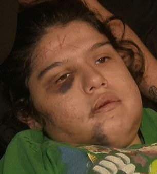 美国女子遭网恋男友脸上刺字,被锁柜子死里逃生,称千万别网恋