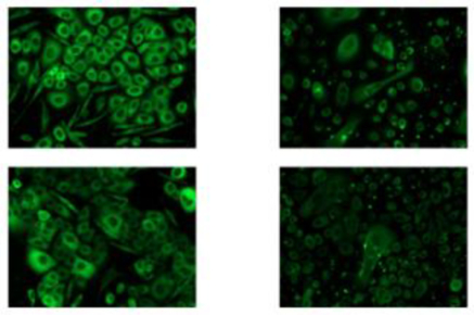 　　▲左边为对照组，右边为OLAY水感透白光塑精华露活性成分稀释液处理组