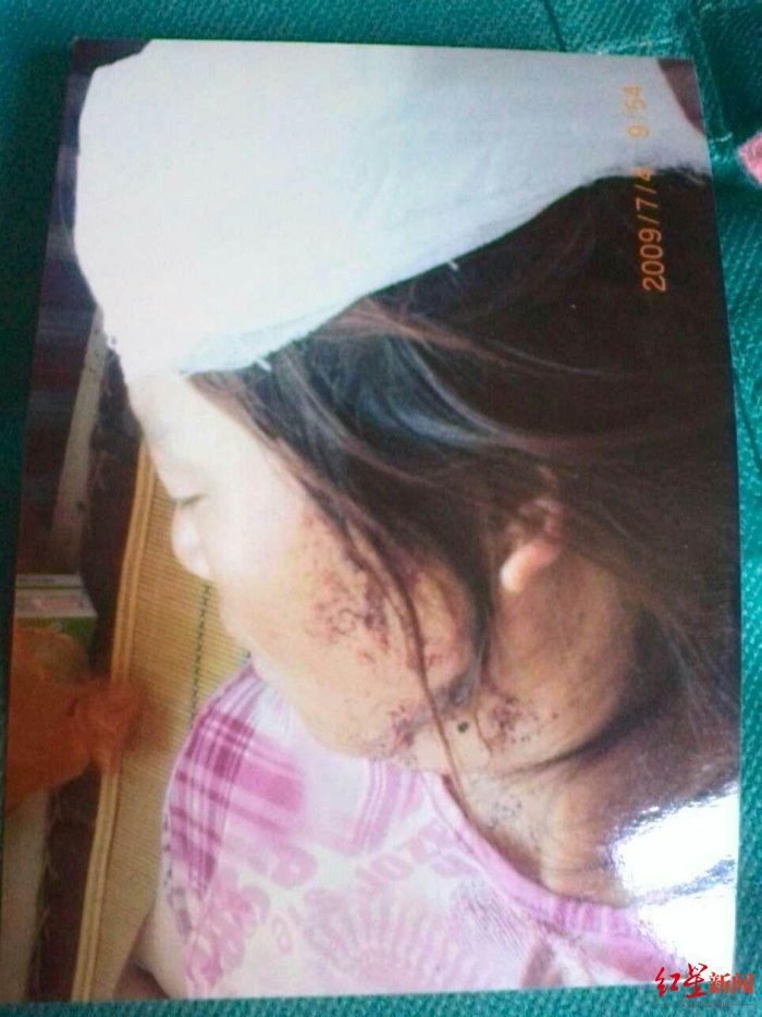 ▲2009年7月3日凌晨，被殴打致伤的常卫云