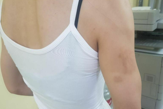 女子饱受虐待毒打。