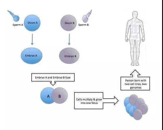 接受骨髓移植后的男人被捐献者的DNA“吞噬”，包括精液