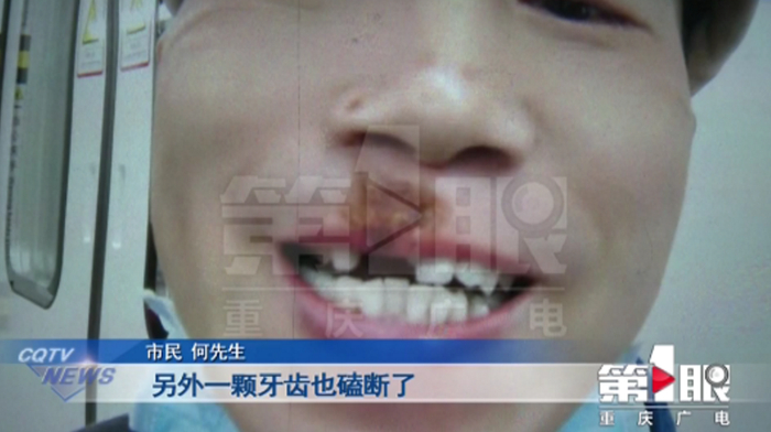 （图片来源▲重庆广电）