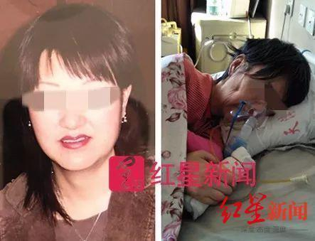 ↑张津华手术前后