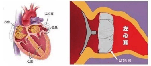 图片来源：丁香园，富途证券整理