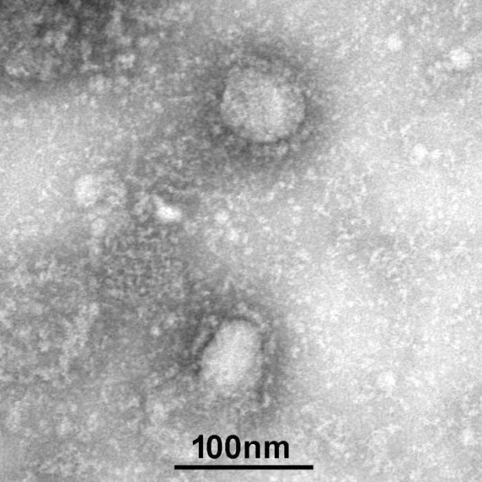 新型冠状病毒长这样！国家病原微生物资源库公布首株病毒电镜照片