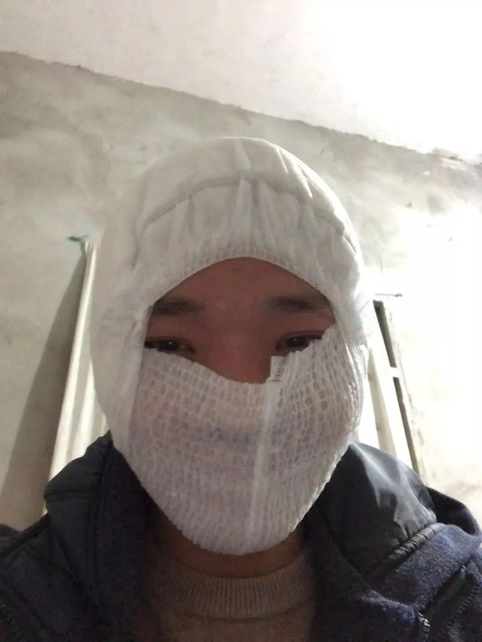  没有口罩，把孩子的尿不湿套在头上