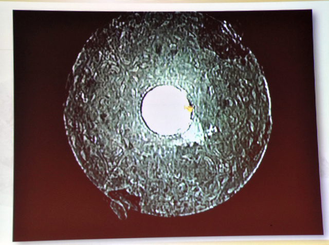 曹操墓中出土的铁镜的CT成像（河南省文物考古研究院）