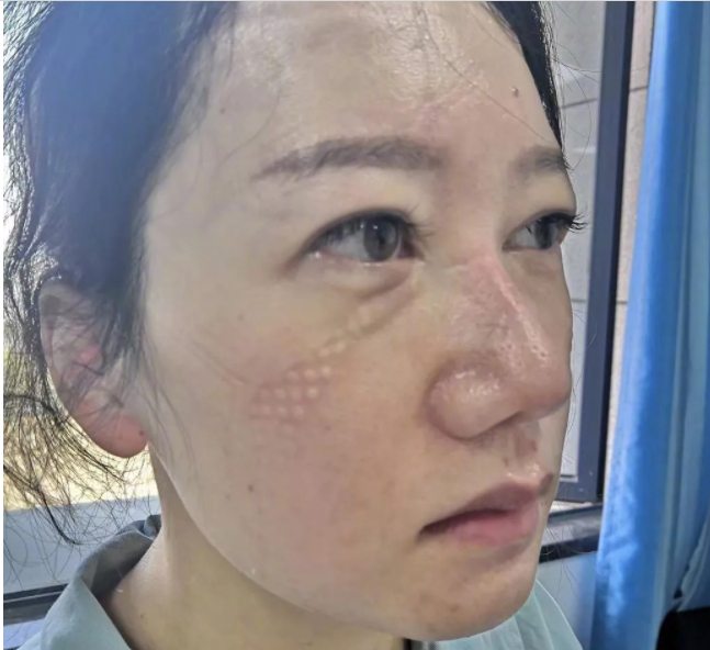 ▲抗疫一线奋战多天后的刘丽。 图片来自微博@人民日报