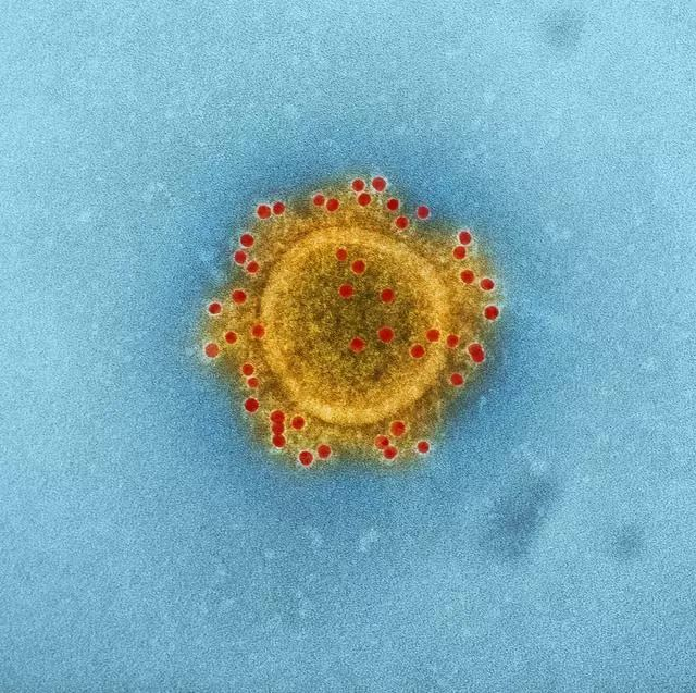 电镜下的 MERS-CoV 病毒照片（图片来源：美国疾控中心网站）