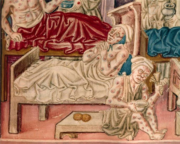 抄本画中描绘身患黑死病的人