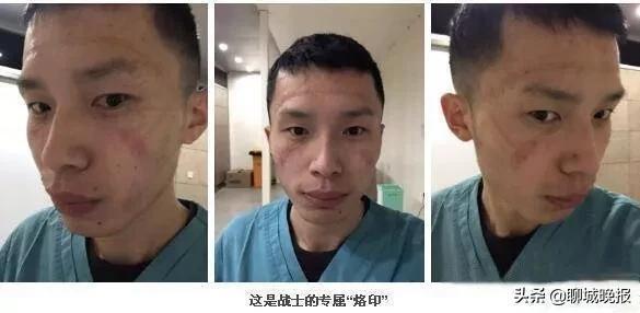 “得知我是山东聊城人，患者哭着说感谢”