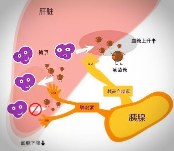 糖尿病患者要重视脂肪肝的防治