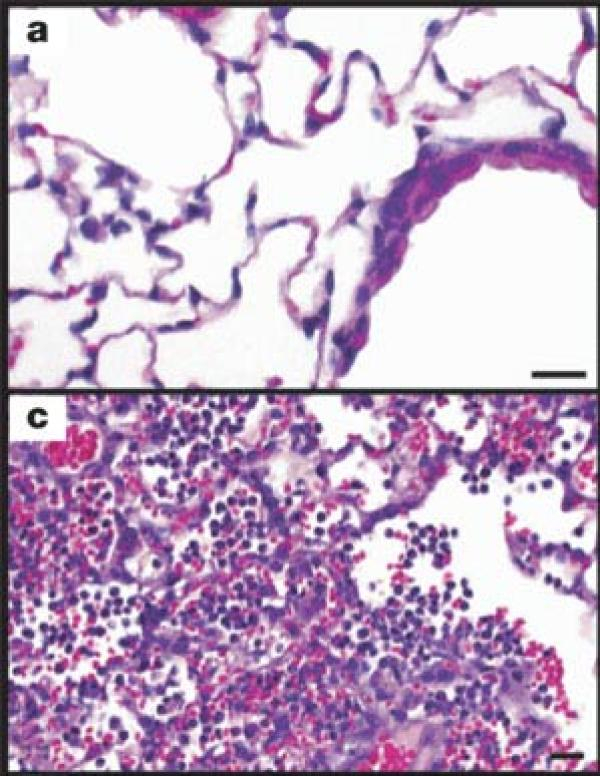 图C显示了1918病毒对小白鼠肺组织的影响