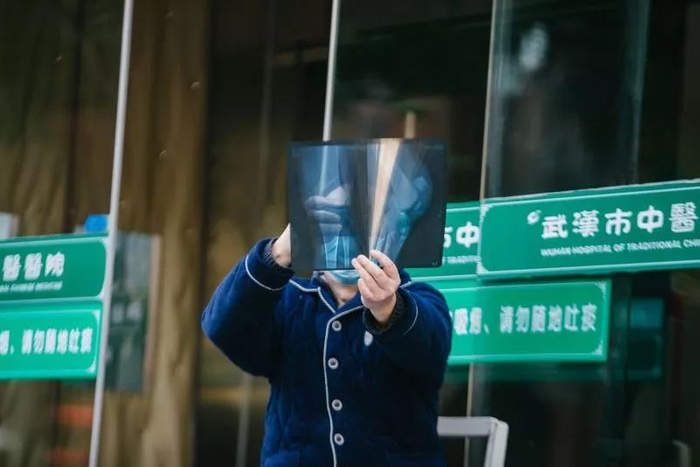 　　2月17日，一位患者来到武汉市中医医院汉口院区，但被告知无法做骨折治疗手术。这家医院刚被公布可以接收非新冠肺炎病人。 　　图片来源：每经记者&nbsp;张建&nbsp;摄