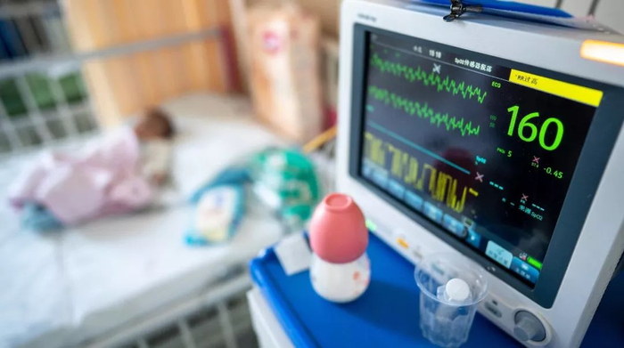 心电检测仪监控小锦媛的生命体征 　　图片来源：每经记者 曹炳梵 摄