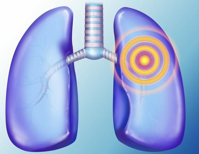 肺有毛病的人，睡觉时会有3种异常，一个没占，肺脏还算健康