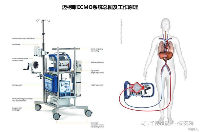 ECMO：向死而生，ICU危重症抢救的终极武器