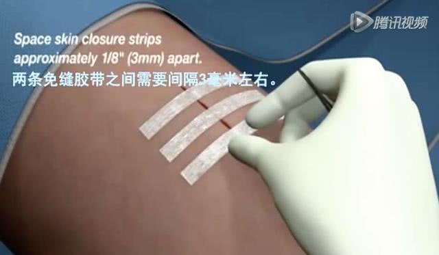 视频截图来自：3M健康教育学院