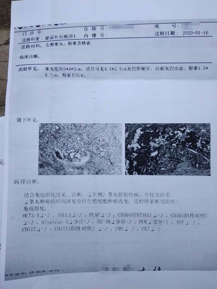 杜女士弟弟的病理报告复印件。受访者供图