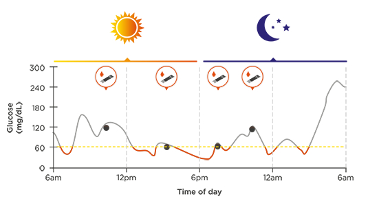 连续血糖监测示意图