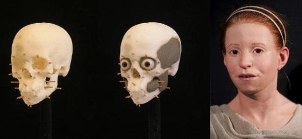 米尔提斯的复原像