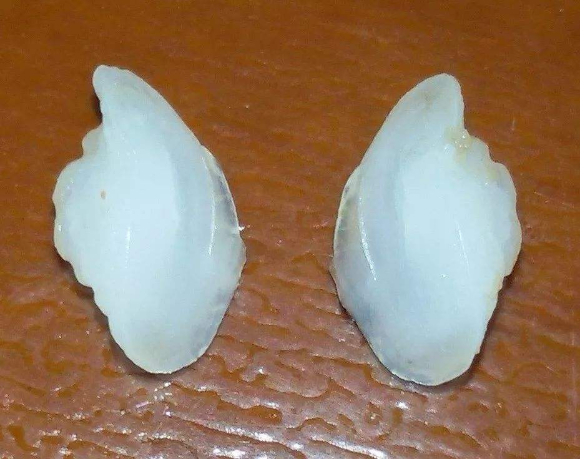 大黄鱼头骨里的两块“石首”