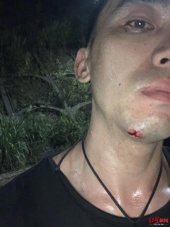 刘东升测试飞行服时摔伤 受访者供图