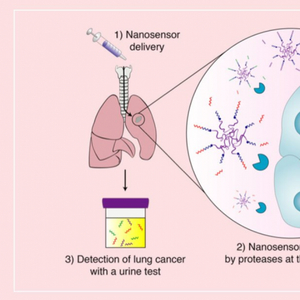 MIT开发的肺癌尿液检查可以消除不必要的活检_手机新浪网
