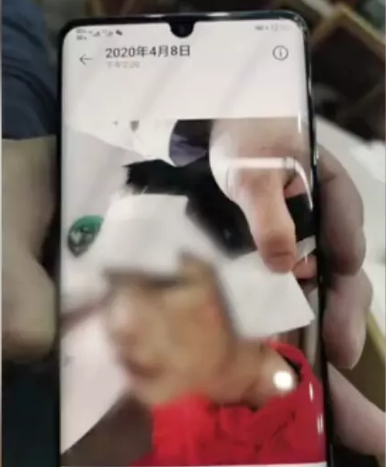 网传被虐打的女童照片。来源：环球网