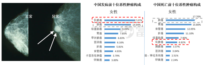 数据来源：维基百科，《2017年中国肿瘤报告》，富途证券整理