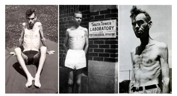 挨饿的实验参与者 图片来源：Mad Science Museum