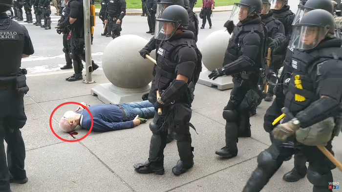75岁抗议者被警察推倒 视频截图
