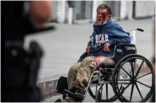 被警察击中的流浪汉 图自社交媒体