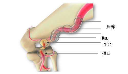 数据来源：某公司推介材料，招商银行研究院