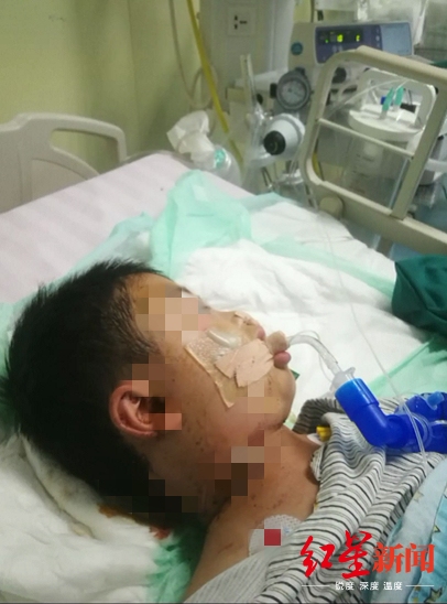 ↑5岁男童小丁被狗咬伤。视频截图