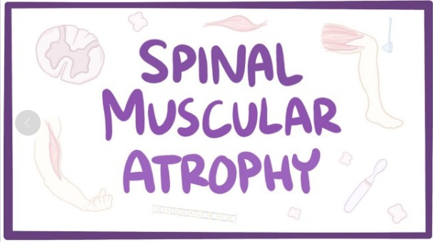  ↑脊髓性肌萎缩症的英文名称Spinal muscular atrophy，又被称为“婴幼儿遗传病杀手”。图据《新医学》杂志