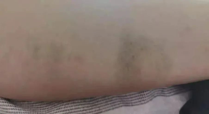 被暴打的孩子照片（家长供图）