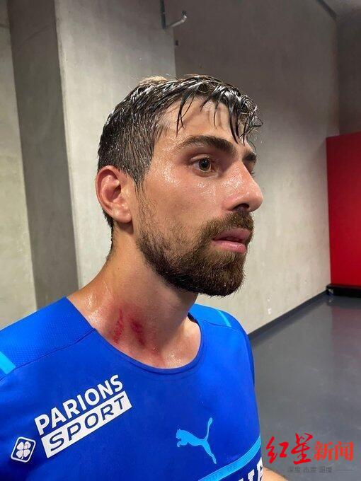 马赛球员脖子受伤