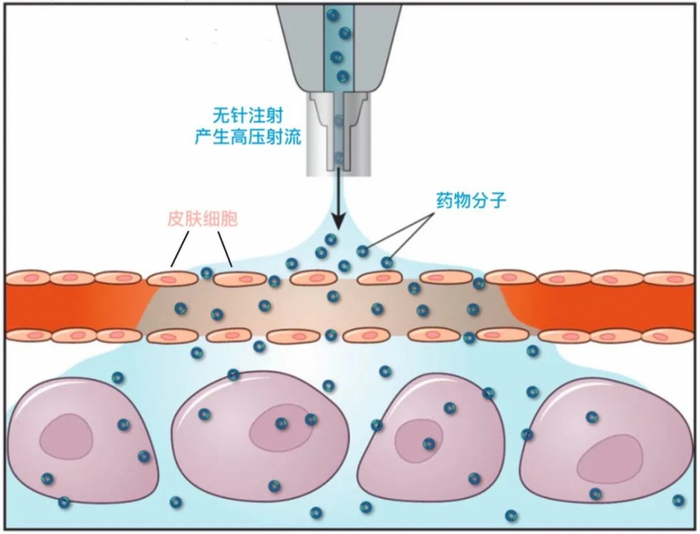 图源：参考文献5