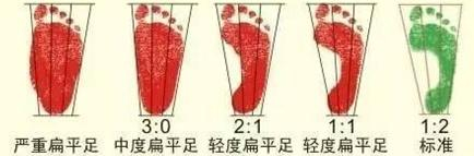 图5：足印法（图片来源于网络）