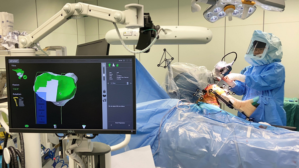 图说：上海市第一人民医院骨科机器人矩阵近日又添“新将” 医院供图（下同）