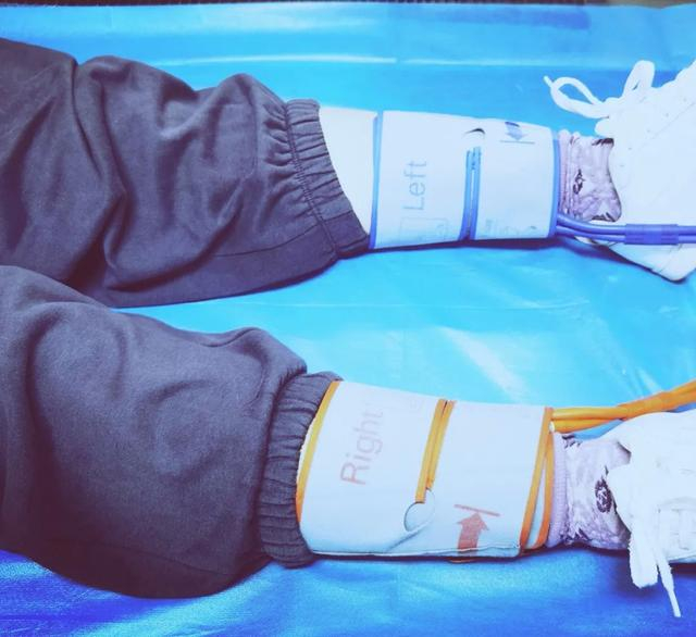 踝部血压测量示意图