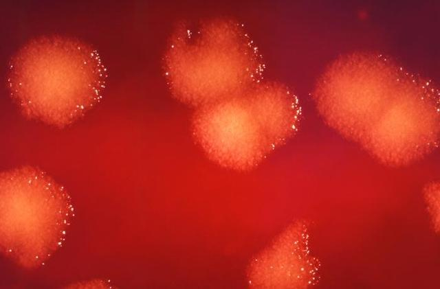 在2.5倍显微镜下，近距离观察培养皿上培养的炭疽芽孢杆菌菌落，图片来自于网络