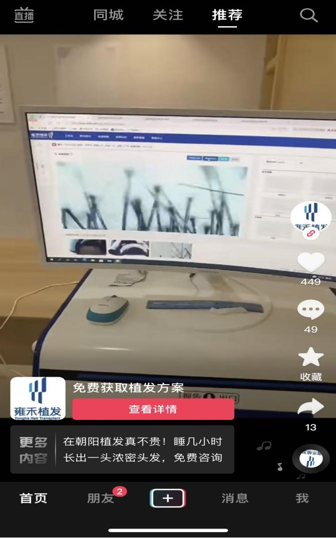 短视频平台植发广告。